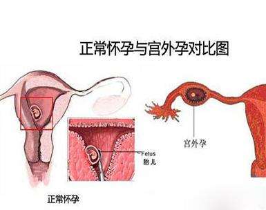 大理42岁试管婴儿可以借卵子吗_大理54岁供卵受孕成功率_日本试管婴儿囊胚移植