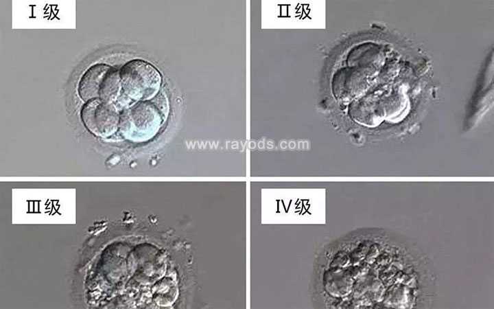 大理家恩德运医院借卵_大理借卵子自怀的最高年龄_二代试管培养的胚胎质量怎